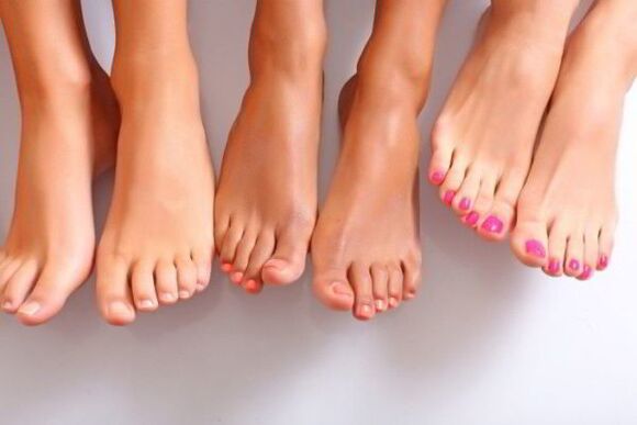 Les causes de l'apparition du champignon sur les ongles