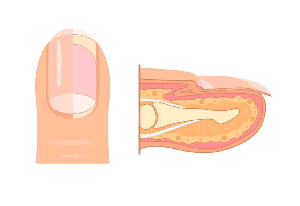 structure des ongles